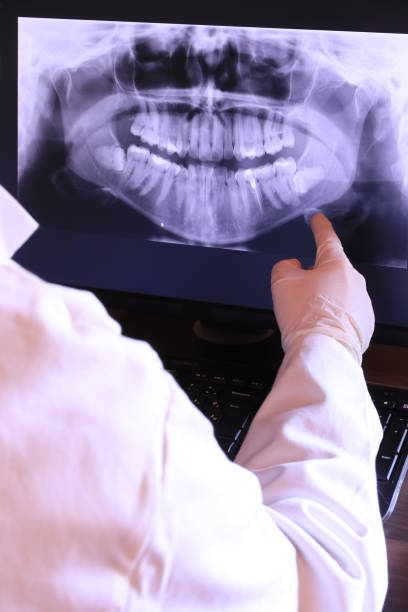 Best Emergency Denture Repair in Winchester, CA