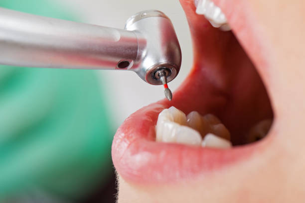 Best Cosmetic Emergency Dentistry in Winchester, CA